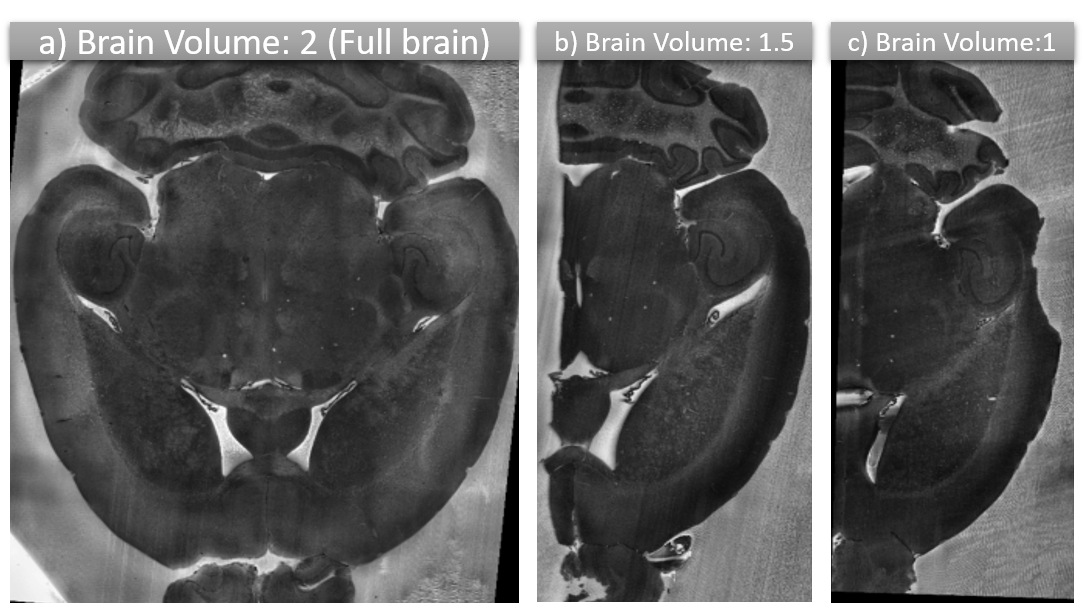 Segmented Half and full brain