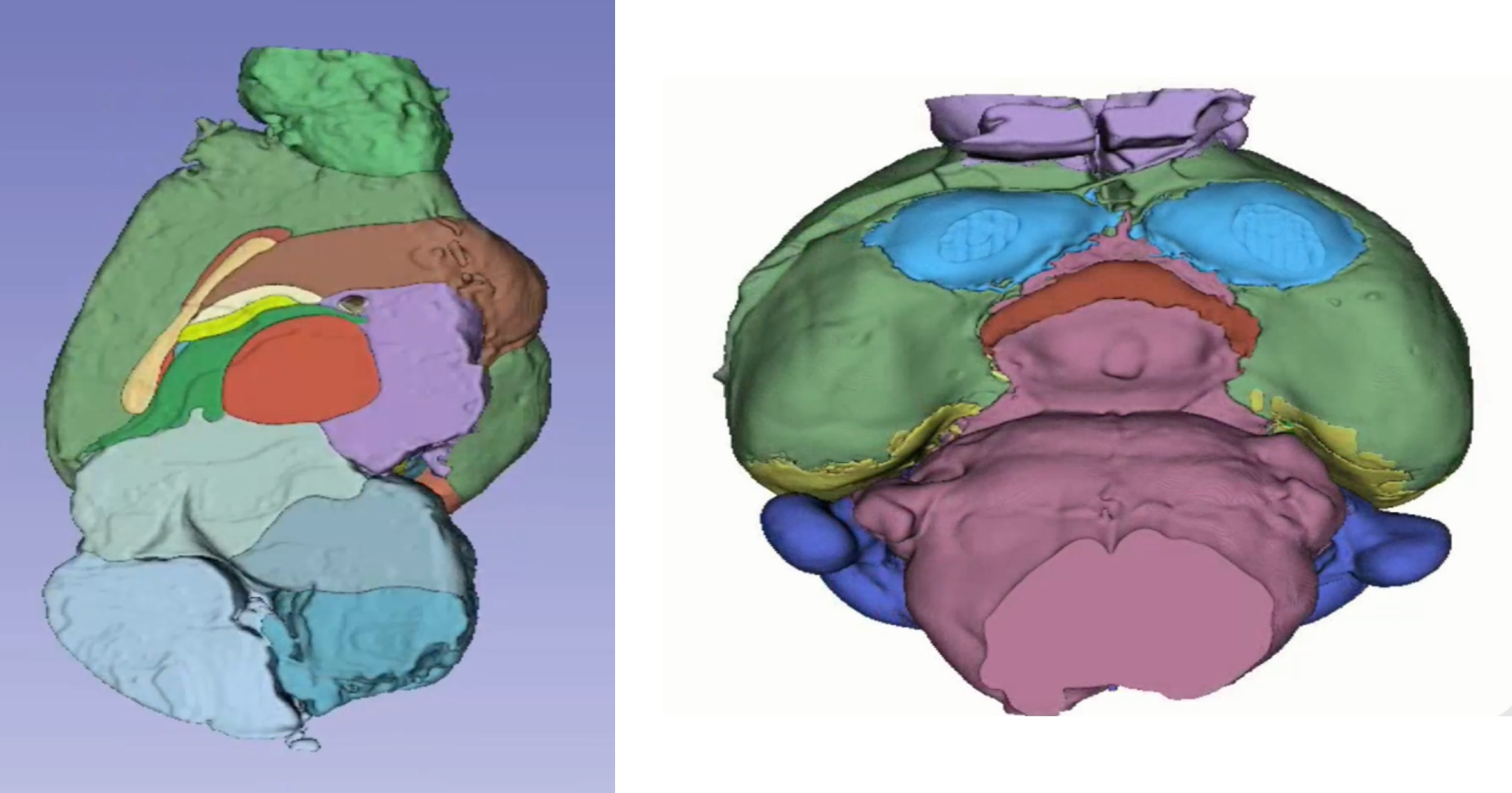 Segmented Half and full brain